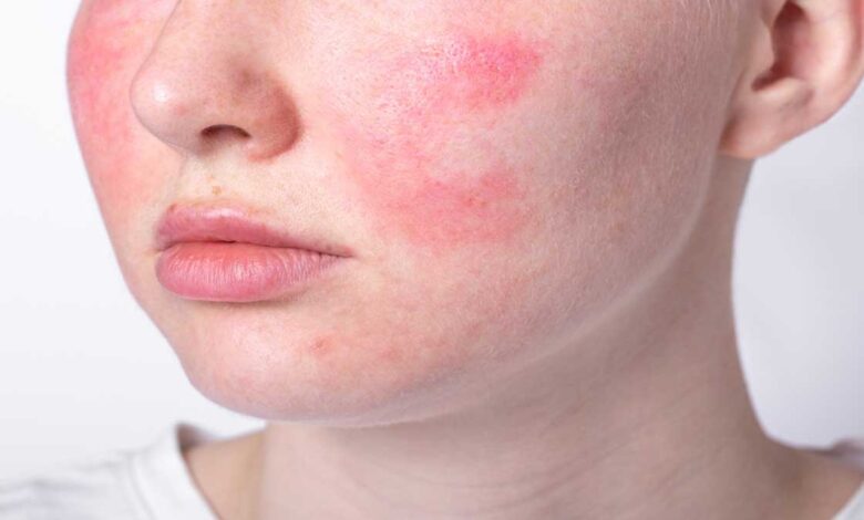 Skincare Tips- Best skincare regimen for glowing skin