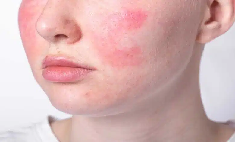 Skincare Tips- Best skincare regimen for glowing skin