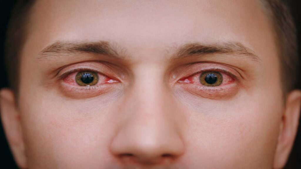 Symptoms and remedies of eye diseases 1