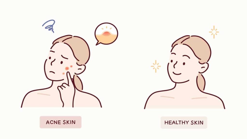 These skincare tips will work to get beautiful skin 1