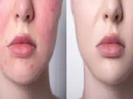 These skincare tips will work to get beautiful skin