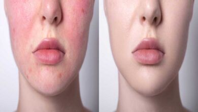 These skincare tips will work to get beautiful skin