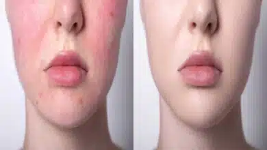These skincare tips will work to get beautiful skin