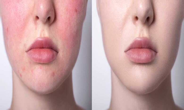 These skincare tips will work to get beautiful skin