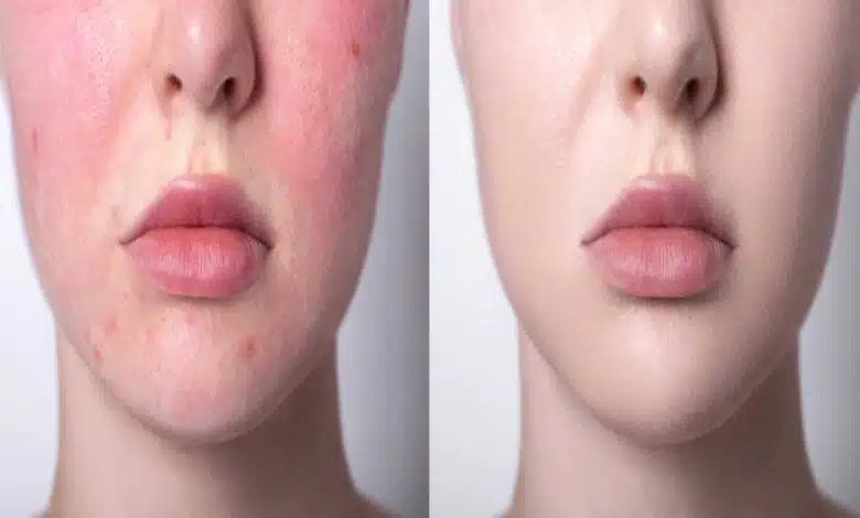 These skincare tips will work to get beautiful skin