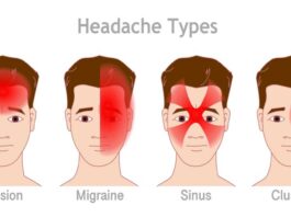 Understanding and Treating Headaches The Detailed Guide