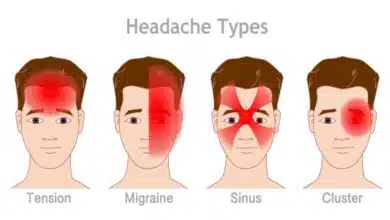Understanding and Treating Headaches The Detailed Guide
