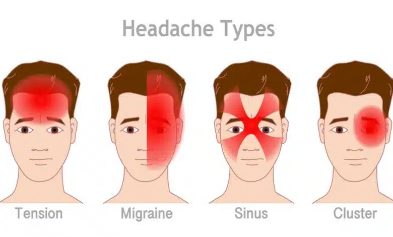 Understanding and Treating Headaches The Detailed Guide