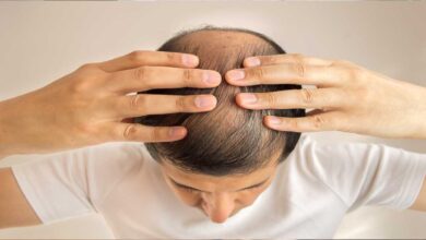Hair fall- Here is the best hairfall solution