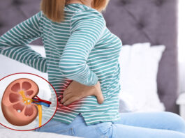What are the 10 signs of kidney disease