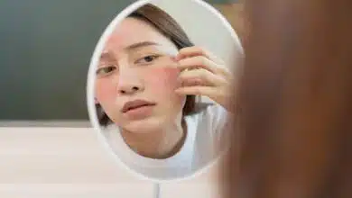 What is the reason for the face becoming black