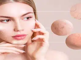 What should be applied on face daily