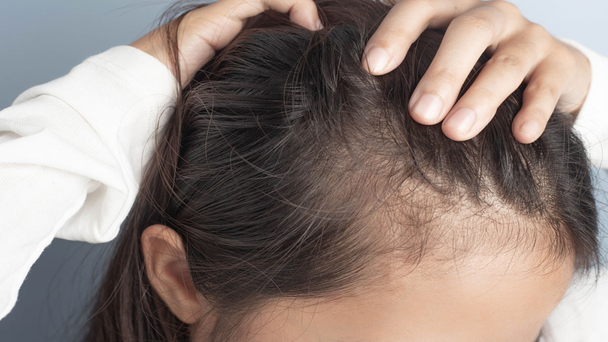 What to apply on hair to prevent hair fall 4