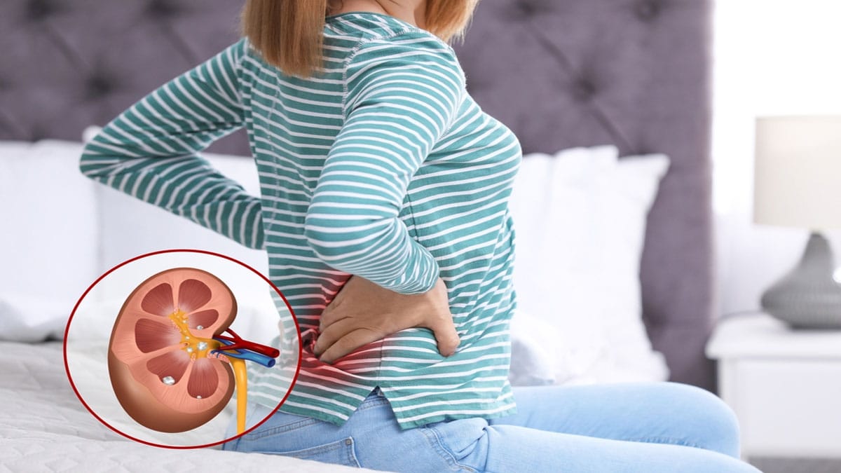 Which is the best fruit for kidneys 2 1