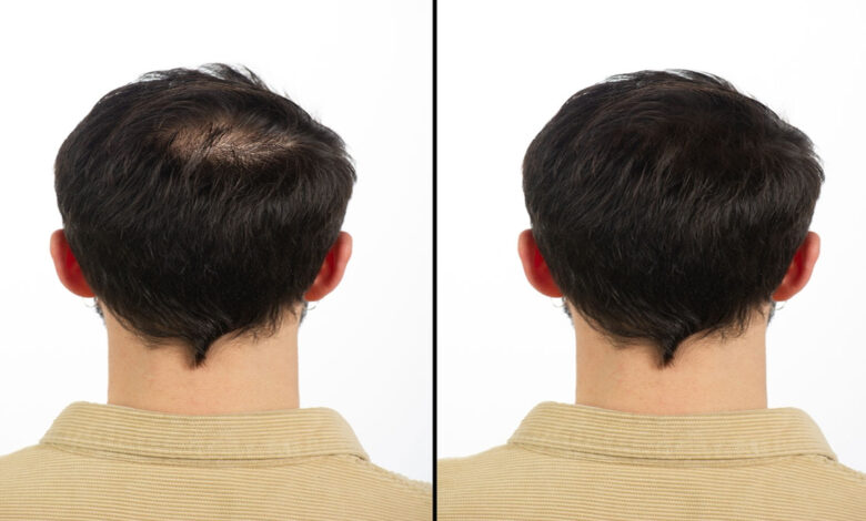 nourish your hair from within