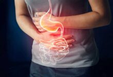10 herbs can help in curing indigestion