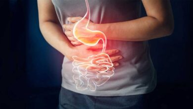 10 herbs can help in curing indigestion