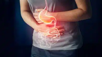10 herbs can help in curing indigestion