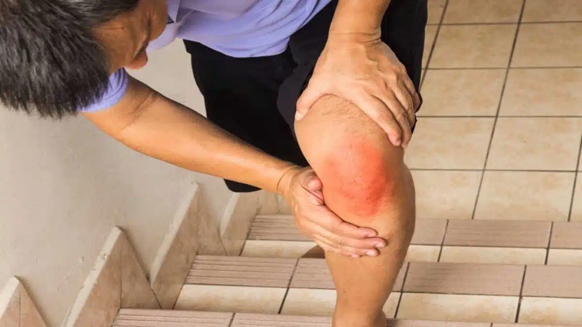 10 miraculous foods to cure knee pain naturally