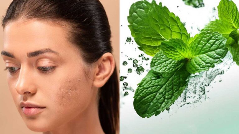 Acne Scars को कम करने के लिए पुदीने की पत्तियों के 5 सरल तरीके