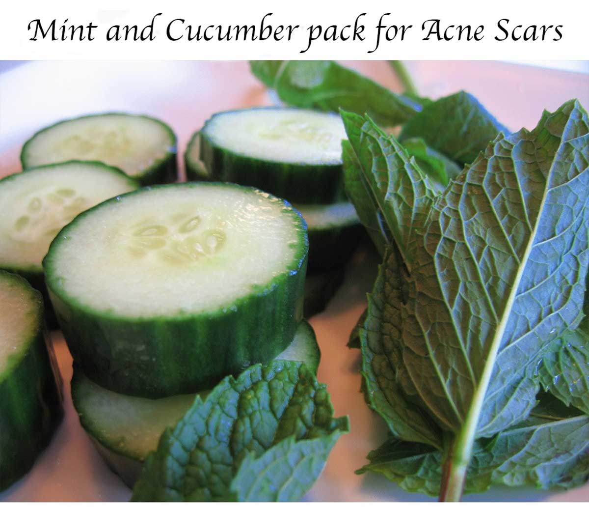 5 Ways to Use Mint Leaves to Reduce Acne Scars