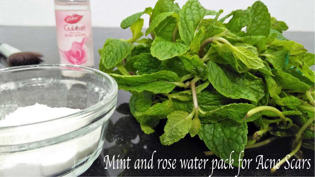 5 Ways to Use Mint Leaves to Reduce Acne Scars