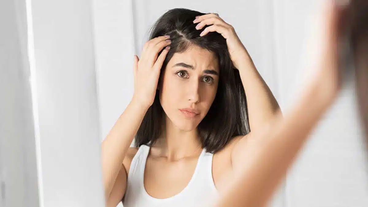 8 easy home remedies to get rid of dandruff