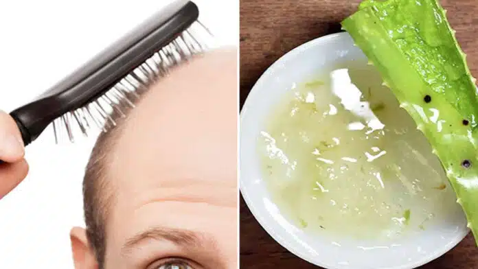 Aloe vera is helpful in removing these 3 hair related problems in summer.