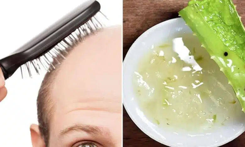 Aloe vera is helpful in removing these 3 hair related problems in summer.