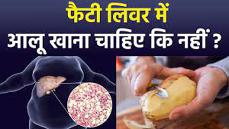 Liver के लिए आलू क्या खराब है?