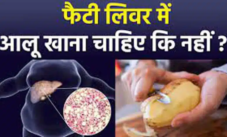 Are potatoes bad for Liver