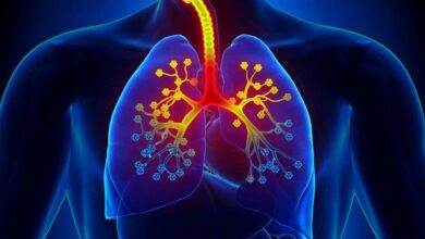 Asthma is a serious disorder