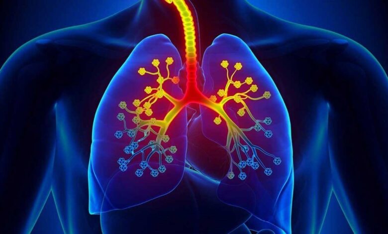 Asthma is a serious disorder