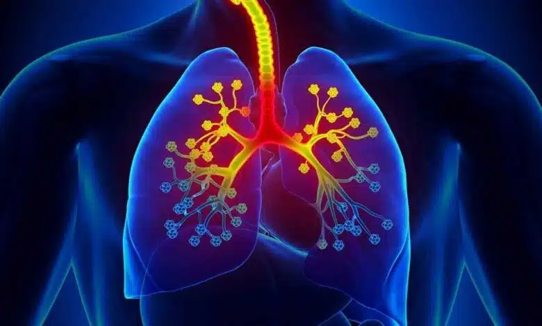 Asthma is a serious disorder