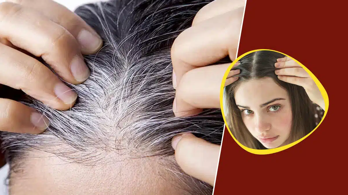 Can Amla cure gray hair?