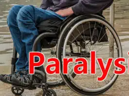 Can paralysis be cured by exercise