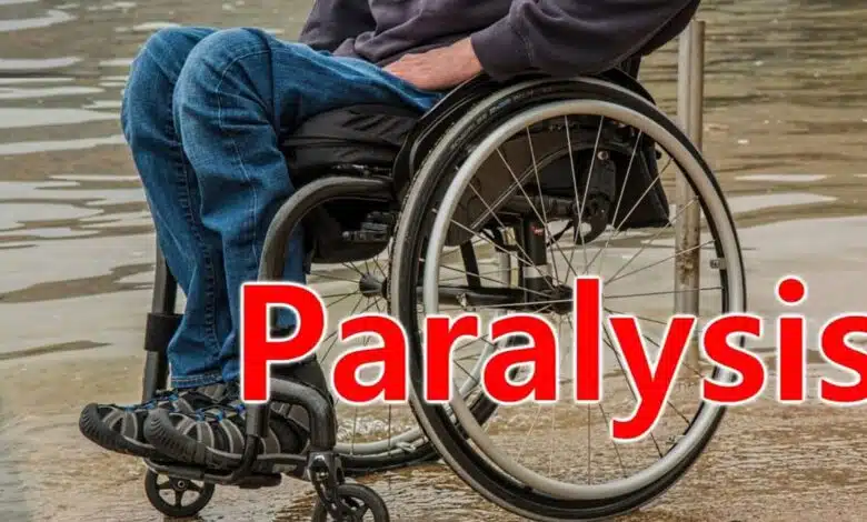 Can paralysis be cured by exercise