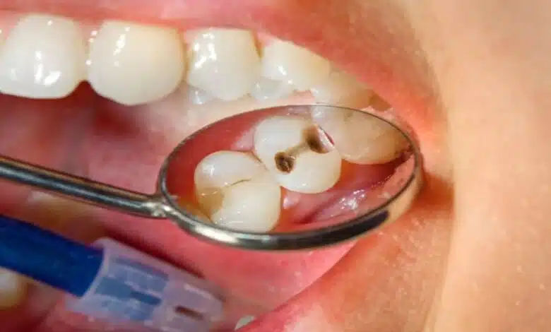 Can rotten teeth be fixed