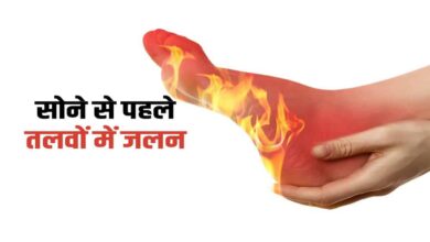 Can't sleep all night due to burning sensation in soles of feet