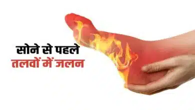 Can't sleep all night due to burning sensation in soles of feet