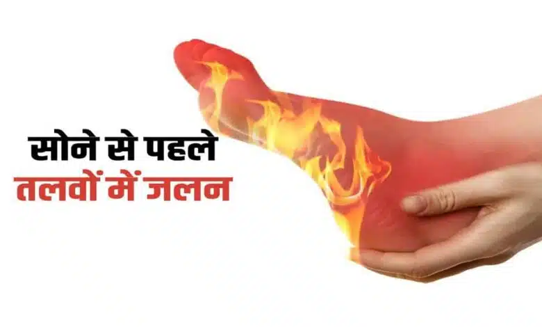 Can't sleep all night due to burning sensation in soles of feet