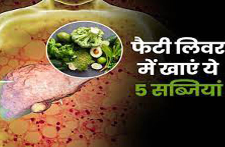 Eat these 5 vegetables for Fatty Liver