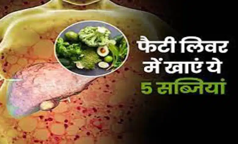 Eat these 5 vegetables for Fatty Liver