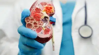 Home remedies to reduce Creatinine level