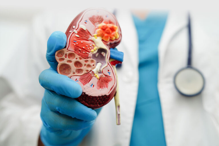 Creatinine लेवल कम करने के घरेलू उपाय