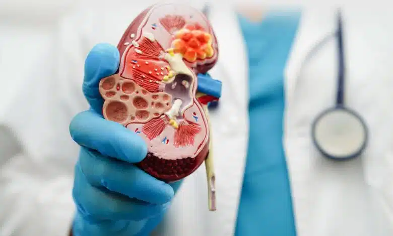 Home remedies to reduce Creatinine level