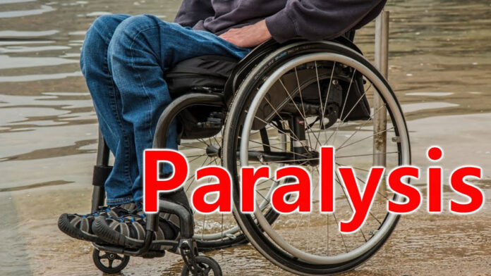 How can chronic paralysis be cured