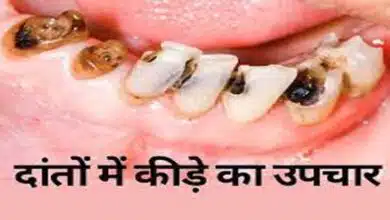 How to eliminate worms from teeth