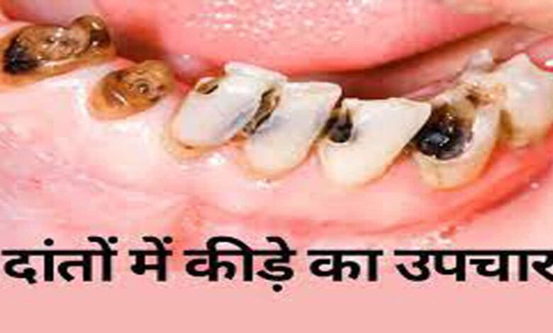 How to eliminate worms from teeth