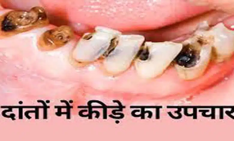 How to eliminate worms from teeth